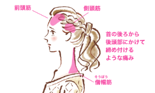 緊張型頭痛