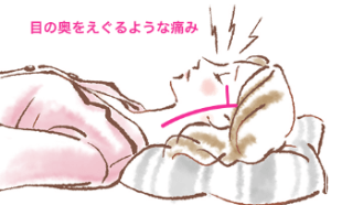 群発頭痛
