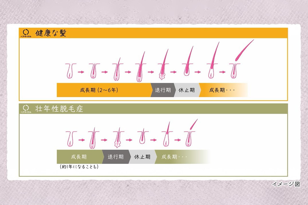 ヘアサイクルを動画で分かりやすく解説。壮年性脱毛症のメカニズムとは。｜リジェンヌヘアケアコンテンツ｜大正製薬